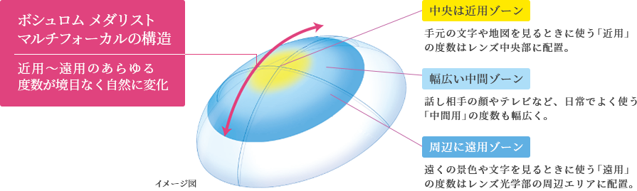 ボシュロム メダリスト マルチフォーカルの構造