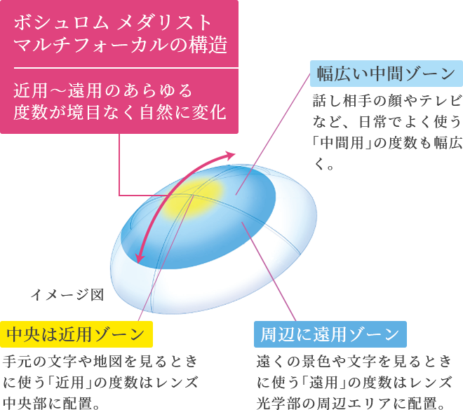 ボシュロム メダリスト マルチフォーカルの構造